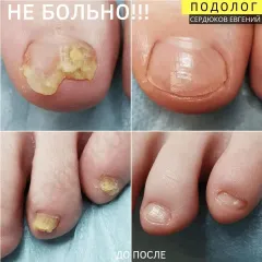 grybok_nigtiv_-1-2