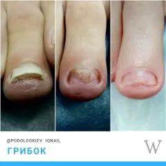 grybok_nigtiv_-9