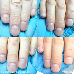 Hands 9