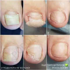Oniholizys_travma_nigtiv-16