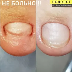 Oniholizys_travma_nigtiv-23