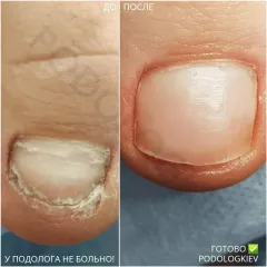 Oniholizys_travma_nigtiv-4