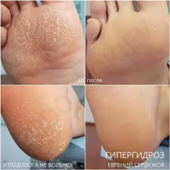 Pedicure 3