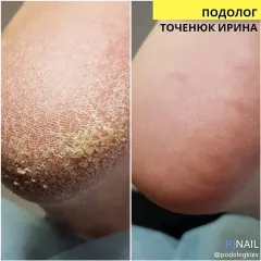 Pedicure 4
