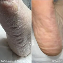 Pedicure 9