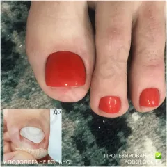 Protezuvannya_nigtiv-1
